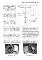 vXZp12